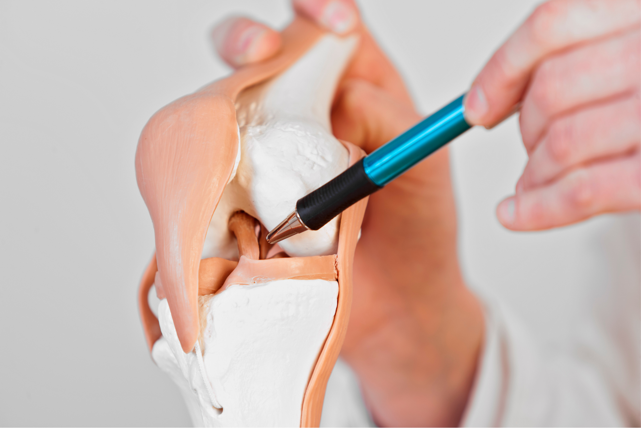 Bloque 4: Ligamentos